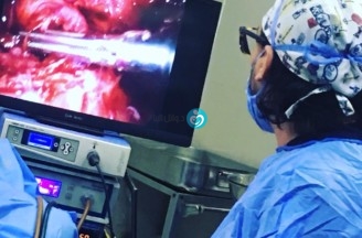 She is now free of pain after suffering of endometriosis for long time