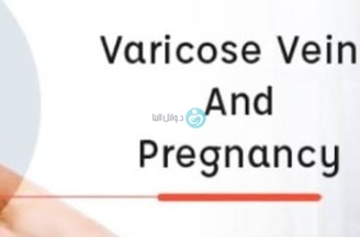 Varicose veins with pregnancy