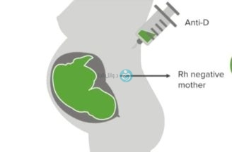 الوقاية من الاجسام المضادة للنساء ذات فصلية دم سلبى