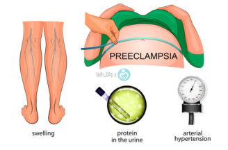 High blood pressure and pre-eclampsia