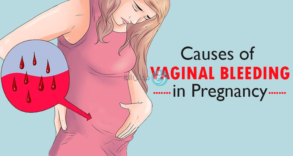 Vaginal bleeding Dr Wael Elbanna د وائل البنا