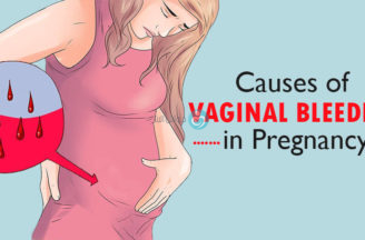 النزيف المهبلي اثناء الحمل