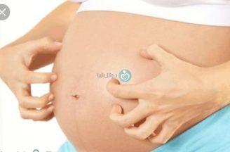 Severe itching and obstetric cholestasis