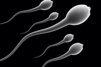 Abnormal sperm morphology: What does it mean?