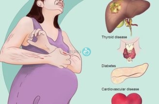 التهاب القنوات المرارية اثناء الحمل (تراكم الصفراء فى الكبد اثناء الحمل)